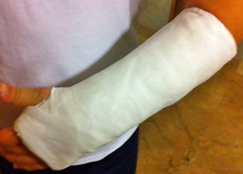 Tartagal: el 31 de julio finaliza el juicio contra dos mujeres por lesiones gravísimas a una niña