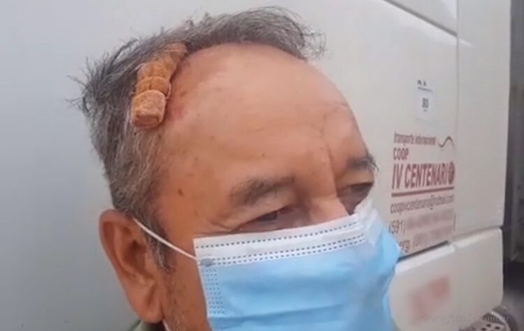 Salvador Mazza: camionero boliviano asaltado y herido en el estacionamiento municipal