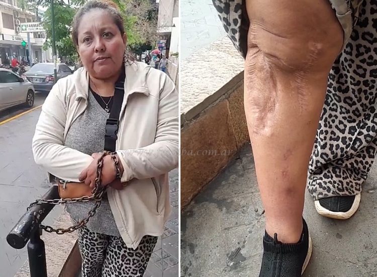 “La única familia que le importa es la de él”: ex trabajadora eventual de la Municipalidad se encadena para recuperar su empleo