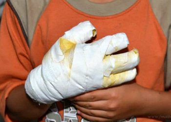 Salvador Mazza: obrero electrocutado en obra, derivado a Salta Capital