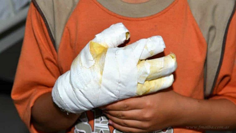 Salvador Mazza: obrero electrocutado en obra, derivado a Salta Capital