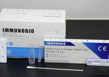 País: ANMAT autorizó la venta libre en farmacias del test rápido que detecta coronavirus
