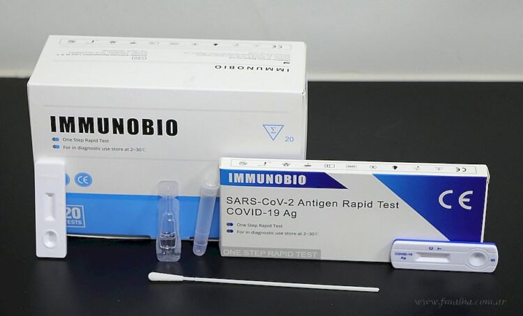 País: ANMAT autorizó la venta libre en farmacias del test rápido que detecta coronavirus