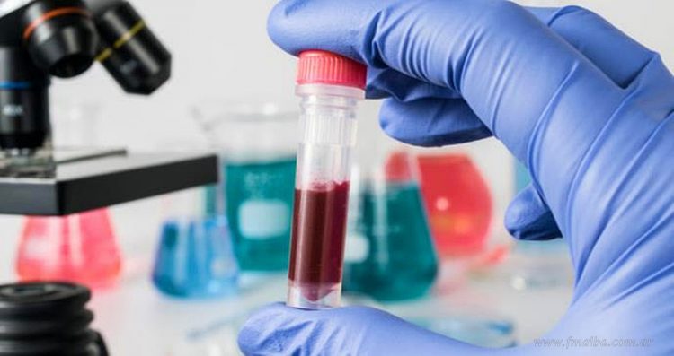 Dengue: segundo caso confirmado en San Martín