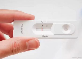 Autotest Covid-19: farmacias de Tartagal seguirán en espera