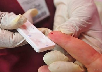 Día Nacional de la Promoción de la Prueba del VIH: testeos gratuitos en Tartagal