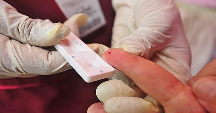 Día Nacional de la Promoción de la Prueba del VIH: testeos gratuitos en Tartagal